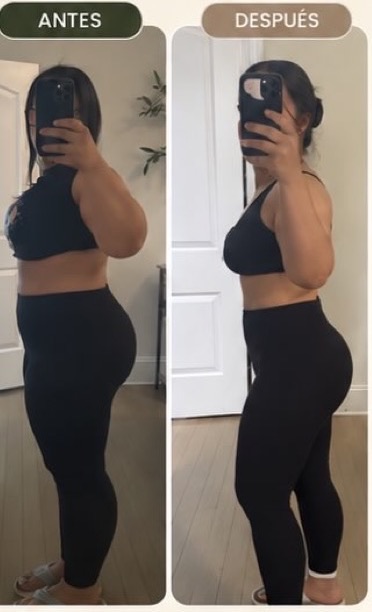 Antes y después de una clienta